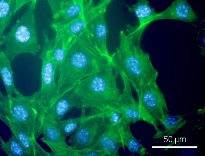 Fluorescent cell image
