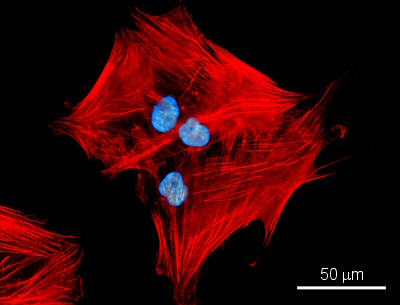 Fluorescent cell image